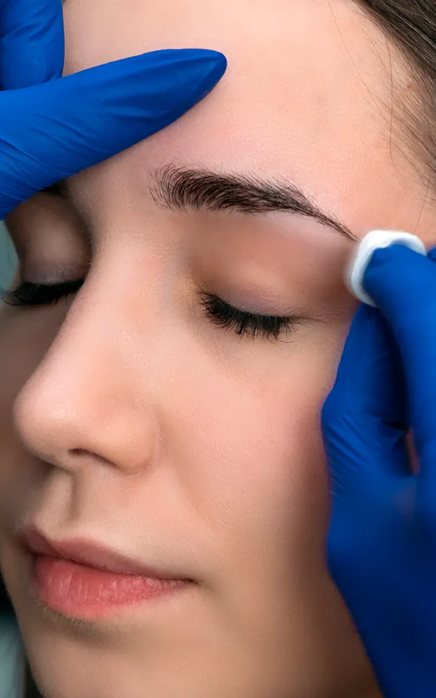 img-Implante de cejas-1