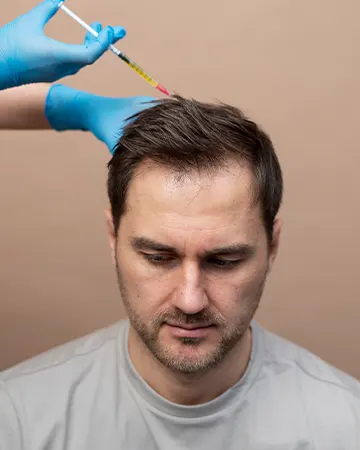 img-mesoterapia-capilar-en-bogota-1-LCP