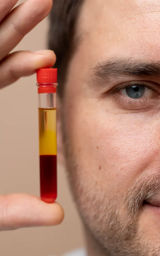 img-plasma-capilar-en-bogota-1